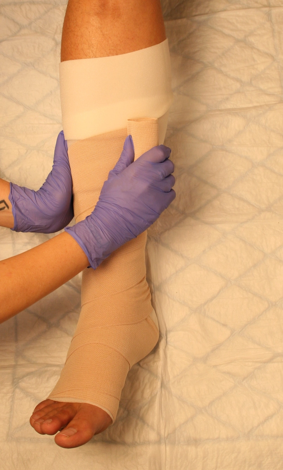 Wundtherapie Eifel - Meike Keul - Verband an Bein und Fuß anlegen